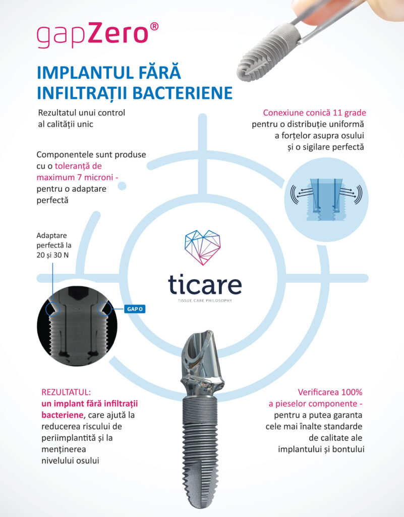 Ticare gapZero