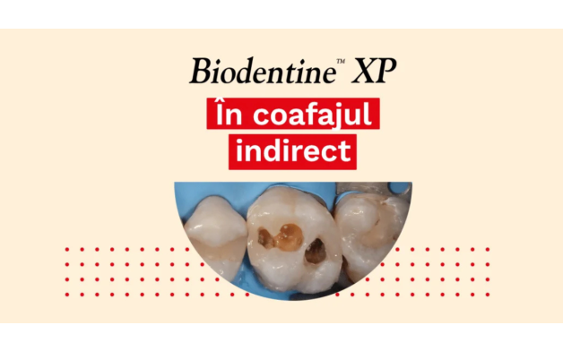 Biodentine XP în coafajul indirect – caz clinic de Dr. Ganowicz