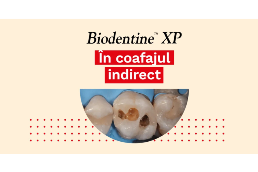 Biodentine XP în coafajul indirect – caz clinic de Dr. Ganowicz