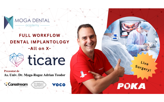 Full workflow in dental implantology; All on X.