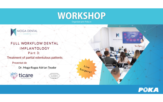 Full workflow in dental implantology - Part 3 Treatment of partial edentulous patients