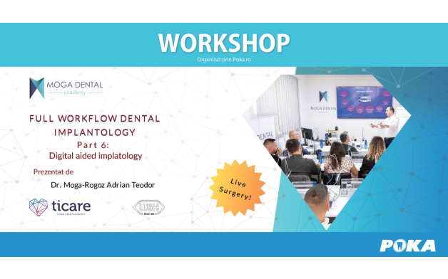 Full workflow in dental implantology - Part 6 Digital aided implatology