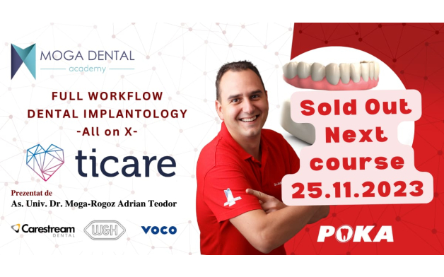 Full workflow in dental implantology; All on X.