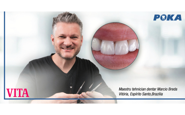 Stratificare eficienta pe supraproteze VITA Lumex AC