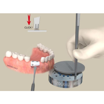 MG Set fixare membrane 14102095