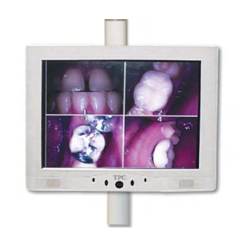 TPC Monitor profesional 15