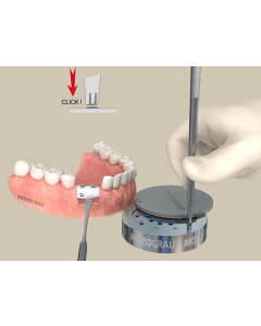 MG Set fixare membrane 14102095