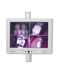 TPC Monitor profesional 15